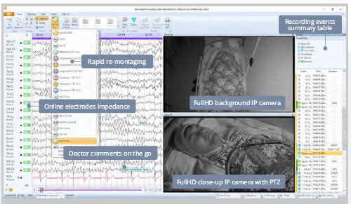   Mitsar Video EEG