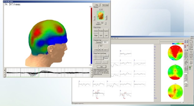 EEG Cihazı - Video EEG Cihazı - 40-80-120-160 Kanal